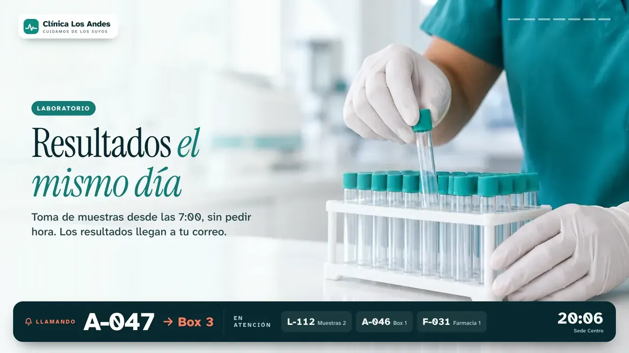 Pantalla de sala con publicidad y la barra de turnos abajo
