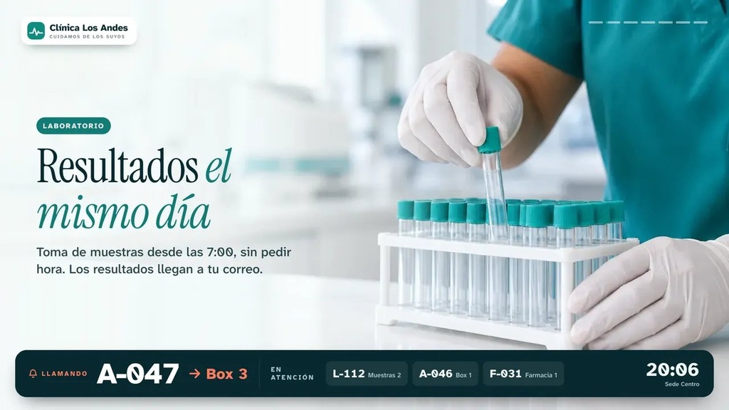 Publicidad en la sala de espera con la barra de turnos